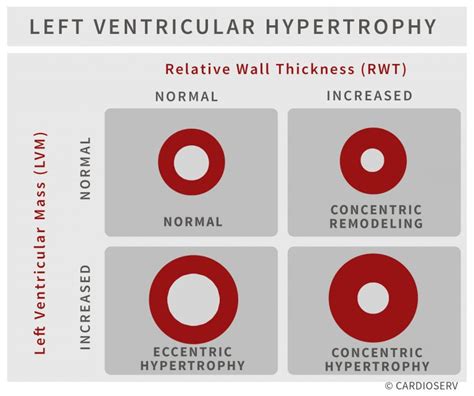 Understanding LVH Part 2: How to Measure LV Mass 